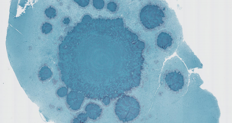 Image of a blue stain created by a cross section of a duck's brain. 