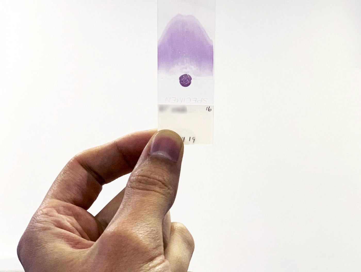 A veterinarian holding a slide with a single drop of blood. 