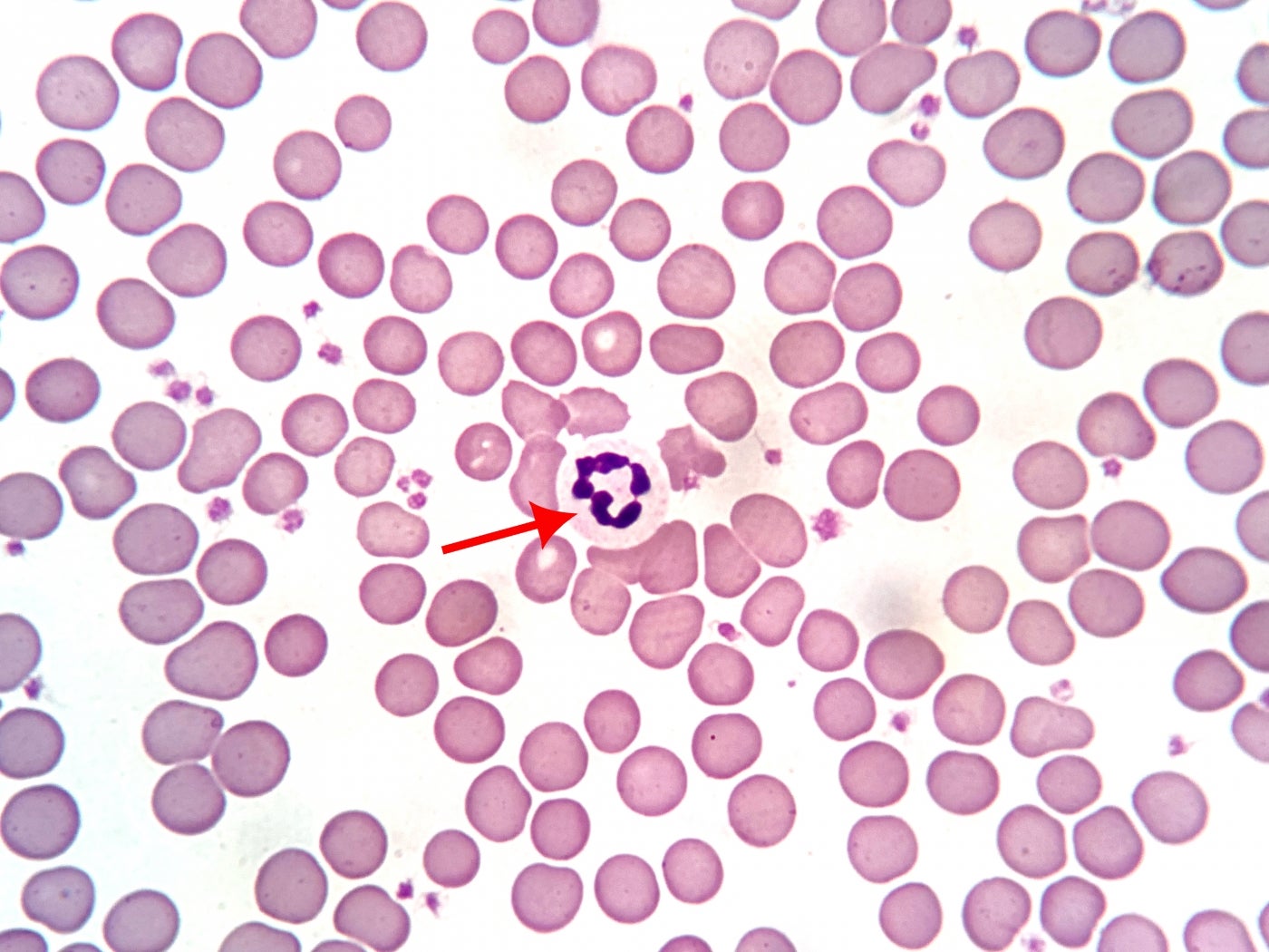 healthy red and white giant panda blood cells 