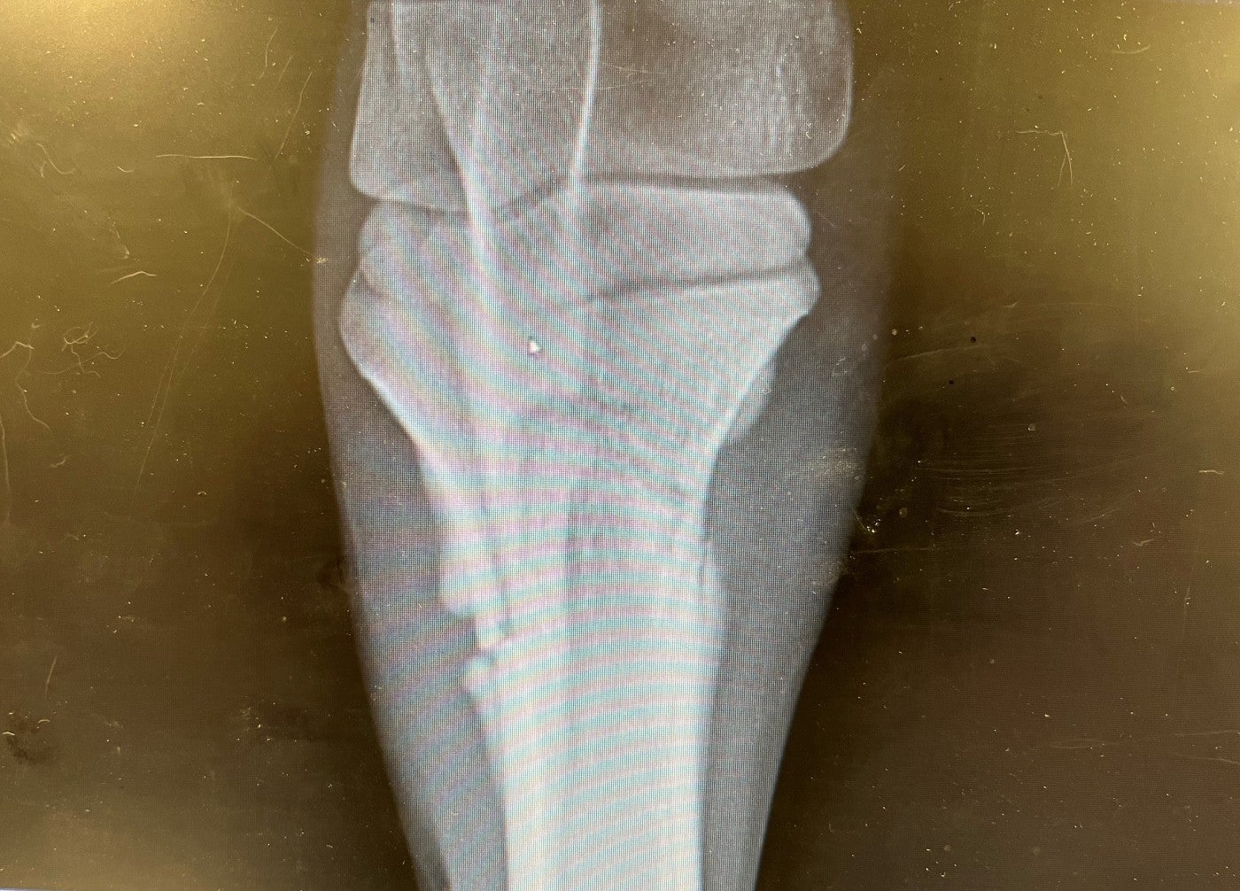 Radiograph image showing a horse's leg. A fracture runs through the middle of the bone.