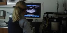 Ultrasound image taken during Quillby's procedure 