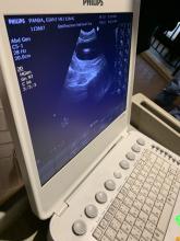 A ultrasound image of a giant panda's uterus