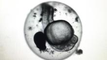 Black-and-white image of a zebrafish embryo under a microscope