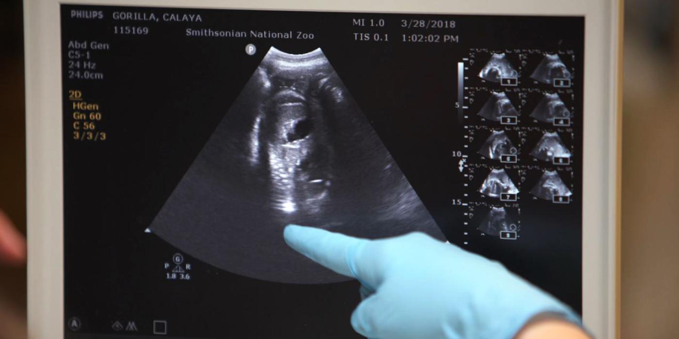 Zoo veterinarian Katharine Hope points to western lowland gorilla Calaya's ultrasound. 