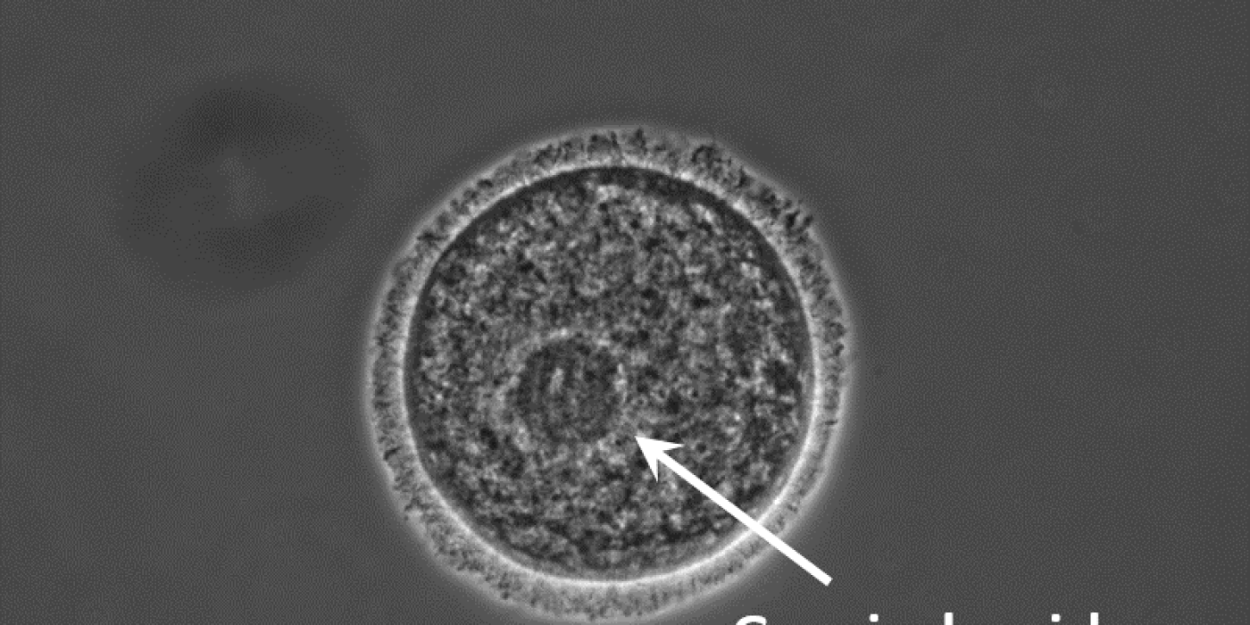 Domestic cat oocyte (egg)